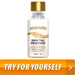 So Smooth Skin Tag Remover